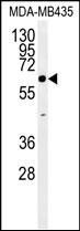 Anti-ERO1LB antibody used in Western blot. GTX53598