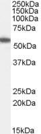 Anti-ETEA / UBXD8 antibody, C-term used in Western blot. GTX14759