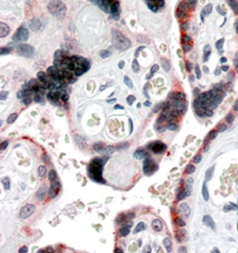 Anti-EVC2 / Limbin antibody, C-term used in IHC (Formalin-fixed paraffin-embedded sections). GTX89863