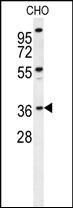 Anti-Exonuclease 5 antibody used in Western blot. GTX53538