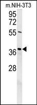 Anti-Exonuclease 5 antibody used in Western blot. GTX53538