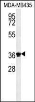Anti-Exonuclease 5 antibody used in Western blot. GTX53538