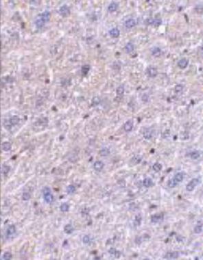 Anti-F1A alpha antibody used in IHC (Formalin-fixed paraffin-embedded sections). GTX23686