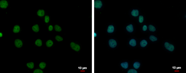 Anti-FAM111B antibody [C1C3] used in ICC/IF. GTX107084