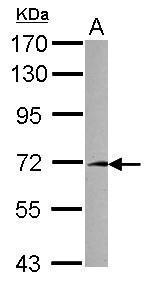 Anti-FAM116A antibody [N3C3] used in Western blot. GTX122457