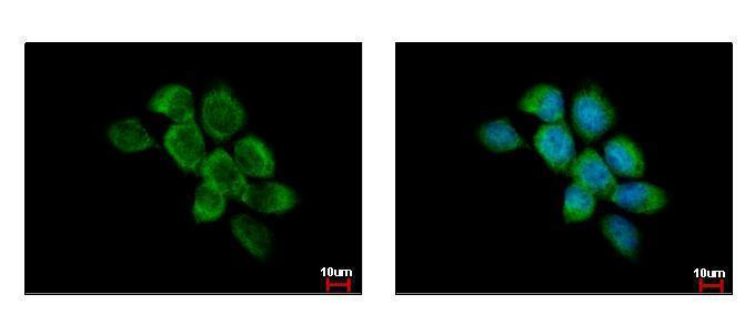 Anti-FAM120A antibody used in ICC/IF. GTX120824