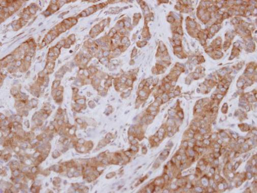 Anti-FAM120A antibody used in IHC (Formalin-fixed paraffin-embedded sections). GTX120824