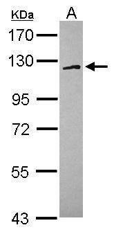 Anti-FAM120A antibody used in Western blot. GTX120824