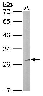 Anti-FAM122B antibody [N1C2] used in Western blot. GTX106678