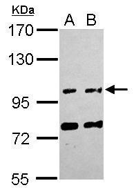 Anti-FAM171A1 antibody [C1C3] used in Western blot. GTX120226