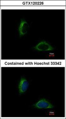 Anti-FAM171A1 antibody [C1C3] used in ICC/IF. GTX120226