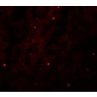 Anti-FAM59A antibody used in ICC/IF. GTX85231