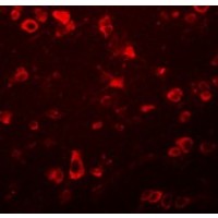 Anti-FAM59B antibody used in ICC/IF. GTX85230