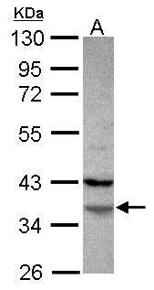 Anti-FAM76A antibody [N3C3] used in Western blot. GTX120378