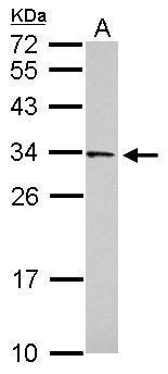 Anti-FAM78B antibody [N2C3] used in Western blot. GTX119928
