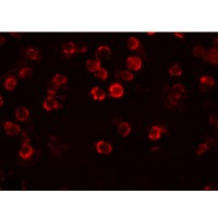 Anti-FAM82A1 antibody used in ICC/IF. GTX85107