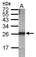 Anti-FAM82B antibody used in WB-Ag. GTX123481