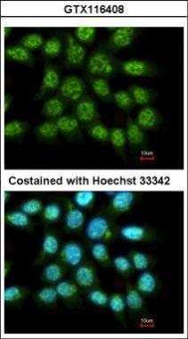 Anti-FAM84A antibody [N1C3] used in ICC/IF. GTX116408