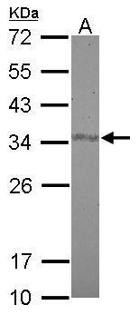 Anti-FAM84A antibody [N1C3] used in Western blot. GTX116408