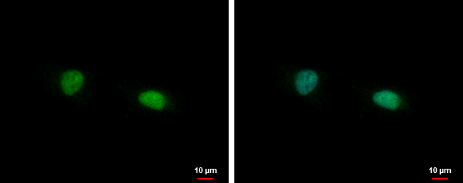 Anti-FAM98B antibody used in ICC/IF. GTX123191