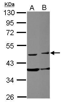 Anti-FAM98B antibody used in Western blot. GTX123191