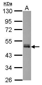 Anti-FAM98B antibody used in Western blot. GTX123738