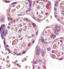Anti-FANCE antibody, Internal used in IHC (Formalin-fixed paraffin-embedded sections). GTX88047