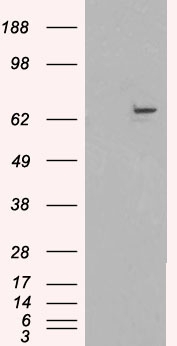Anti-FANCG / XRCC9 antibody, C-term used in Western blot. GTX89053