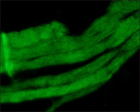 Anti-fast skeletal Myosin antibody [MY-32] used in ICC/IF. GTX27784