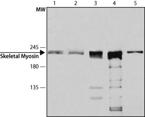Anti-fast skeletal Myosin antibody [MY-32] used in Western blot. GTX27784