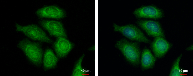 Anti-FASTKD1 antibody [C1C3] used in ICC/IF. GTX107835