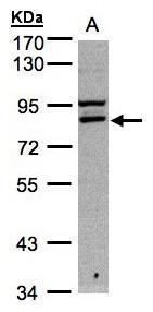 Anti-FASTKD1 antibody [C1C3] used in Western blot. GTX107835