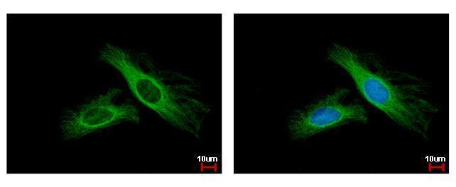Anti-FBL6 antibody [C3], C-term used in ICC/IF. GTX104866