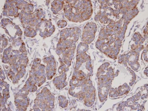 Anti-FBL6 antibody [C3], C-term used in IHC (Formalin-fixed paraffin-embedded sections). GTX104866