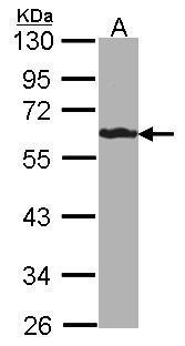 Anti-FBL6 antibody [C3], C-term used in Western blot. GTX104866