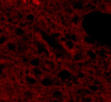 Anti-FBRSL1 antibody used in IHC (Formalin-fixed paraffin-embedded sections). GTX51916