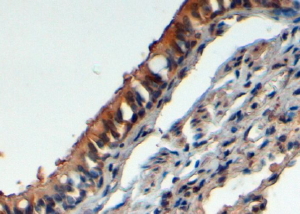 Anti-FBXL12 antibody, C-term used in IHC (Formalin-fixed paraffin-embedded sections). GTX25305