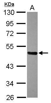 Anti-FBXL16 antibody [N2C3] used in Western blot. GTX120503