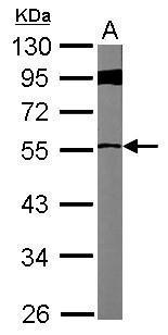 Anti-FBXL7 antibody used in Western blot. GTX117601