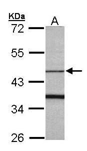 Anti-FBXO15 antibody [N1C1] used in Western blot. GTX107090