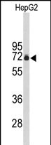 Anti-FBXO3 antibody, C-term used in Western blot. GTX80503
