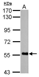 Anti-FBXO7 antibody used in Western blot. GTX101986