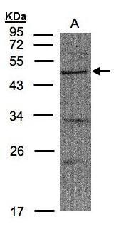 Anti-FBXW2 antibody used in Western blot. GTX104863