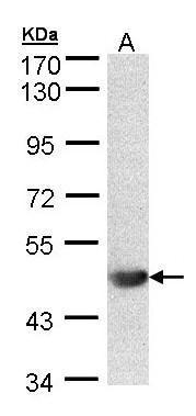 Anti-ALG1 antibody [N1C2] used in Western blot. GTX103537