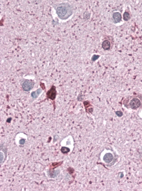 Anti-Ferritin Light Chain antibody, C-term used in IHC (Formalin-fixed paraffin-embedded sections). GTX88496