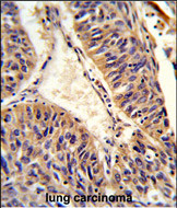 Anti-ALG14 antibody, Internal used in IHC (Formalin-fixed paraffin-embedded sections). GTX80951
