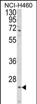 Anti-ALG14 antibody, Internal used in Western blot. GTX80951