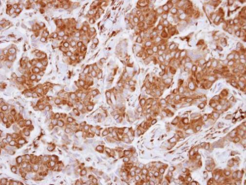 Anti-FEZ1 antibody [C1C3] used in IHC (Formalin-fixed paraffin-embedded sections). GTX117376