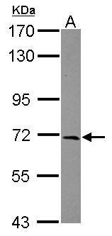 Anti-FEZ1 antibody [C1C3] used in Western blot. GTX117376