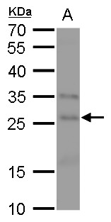 Anti-FGF18 antibody used in Western blot. GTX128496